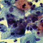 Δοκιμασία οξικού οξέως